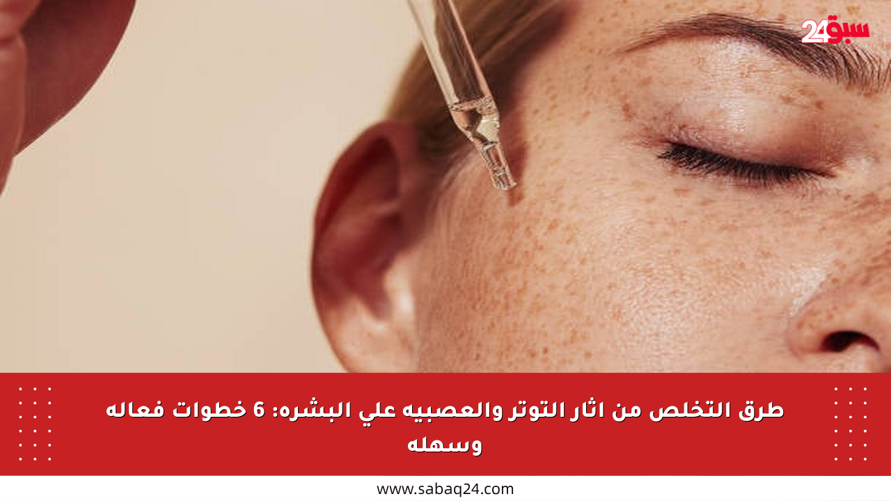 طرق التخلص من آثار التوتر والعصبية على البشرة: 6 خطوات فعالة وسهلة